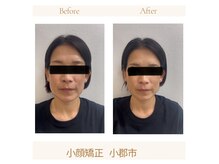 堺整骨院 小郡院の雰囲気（エラ張り、食いしばりのお悩みにも大変喜ばれています）