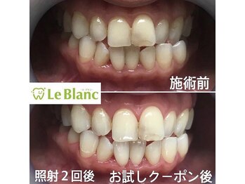 ルブラン 奈良店(Le Blanc)/ご自身へのご褒美に!!