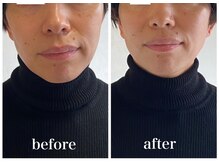 ディアンヌ(Diane)/猫背/ゆがみ/骨盤/肩コリ/小顔