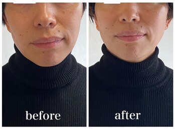 ディアンヌ(Diane)/猫背/ゆがみ/骨盤/肩コリ/小顔