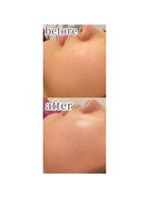 ノノサロン(nono salon)/