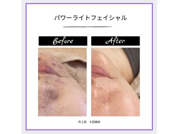 サロン ロワ(Salon Rowa)/お肌悩みに寄り添います