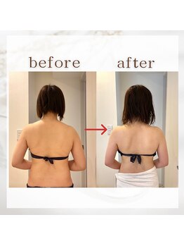 イルソーレ バイ フェリーチェ(il sole .by felice)/背中ケアもお任せください☆