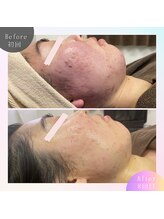 ビューティサロン ベルティア(Beltia)/#ダイエット#痩身#ブライダル