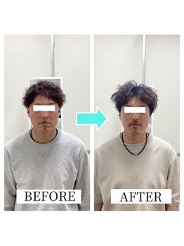 小顔矯正専門店 シンメトリー 千葉中央店の写真/【メンズ小顔 小顔矯正◎】男性も美活の時代!優しいタッチの施術でお顔の歪みを整え好印象フェイスに☆