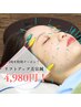 3周年限定クーポン☆再来様【たるみ】リフトアップ美容鍼8,500円→4,980円！