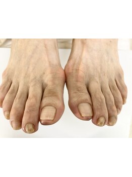 爪の悩みを解消できる（ケア含む）