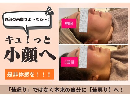 フォーエリミスプラス(for elims+)の写真