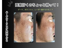 リオル(Rior)の雰囲気（ニキビケア、毛穴美肌、コモデックス他クリスティーナ取扱店）