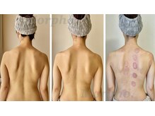 モルフォ(Morpho.)の雰囲気(凝り、身体の歪みを解消♪疲れにくくなり眠りの質も良くなります)