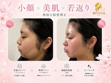 サロン エマ(salon emma)