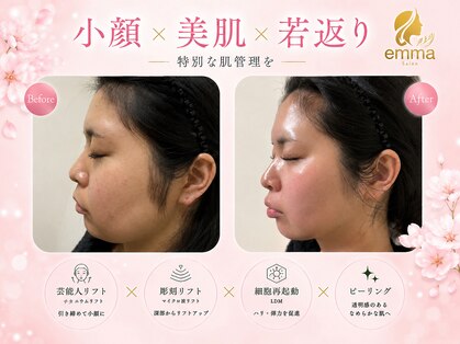 サロン エマ(salon emma)の写真