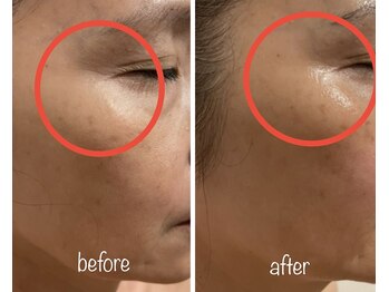 ラヴィエ ベル(La vie est belle)/気になる目尻に!!