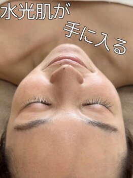 マヴィ 香里園店(MavY.)/ノンニードル水光注入の秘密