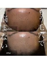 エレナ(Elena)/毛穴ゼロのお肌へ