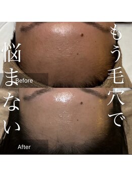 エレナ(Elena)/毛穴ゼロのお肌へ