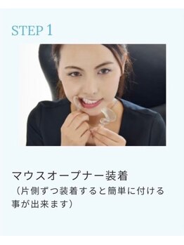 ホワイトニングショップ 阪急伊丹店/ホワイトニングの進め方