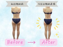ミネット(minette)の雰囲気（気にされていたヒップ下がひと回り小さく♪すっきりした印象に◎）