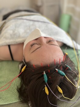 久心宝鍼灸院/~とにかく頭鍼~