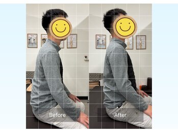 ナオル整体 京都花園院(NAORU整体)/20代 男性 姿勢改善!