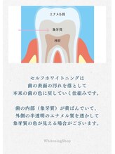 ホワイトニングショップ 本八幡店/ホワイトニング専門店 市川