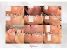 ビジュープラス 水戸店(Bijou+)