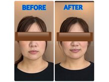 ラゾプラス(Lazo plus)の雰囲気（毎月通われている方の１回の施術変化。姿勢から整える事が大事！）