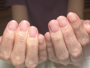 デイジー(DAISY)の写真/《丁寧なカウンセリング◎》薄くなった爪から健康なお爪へ！長年お悩みがある方もなんでもご相談ください☆