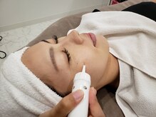 細かいシミも丁寧にケアしていきます。色ムラのないお肌に