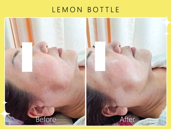 シロカネ イオンタウン西熊本店(SHIROKANE)/レモンボトル☆