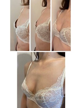 フェリス(Feliz)/【バストアップ/育乳/安城】