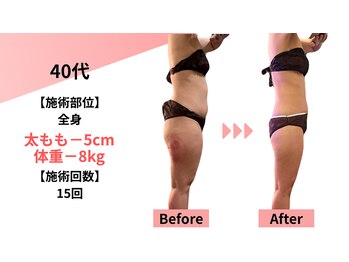 クレビア(Clevia)/Clevia-クレビア