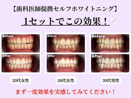 ファストホワイトニング くずは店(FAST WHITENING)の写真