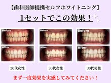 ファストホワイトニング くずは店(FAST WHITENING)