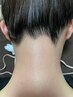 【NEW 女性限定モニター枠】うなじ+もみあげ シュガーリング+光のW脱毛