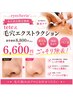 【本日限定】毛穴エクストラクション 毛穴ゼロの陶器肌をGET8000円→6000円