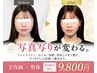 【写真写りでお悩みの方へ】小顔美容鍼×ドライヘッドスパ　90分