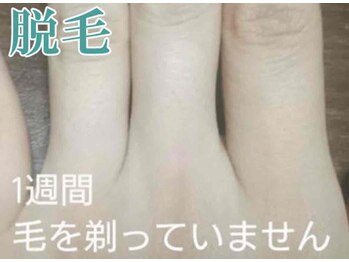美宝 元町の写真/32年愛され続ける実力派の美肌脱毛サロン★痛み少なく超早【元町駅３０秒】信じられない感動◎乗り換え多数