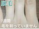 美宝 元町の写真/32年愛され続ける実力派の美肌脱毛サロン★痛み少なく超早【元町駅３０秒】信じられない感動◎乗り換え多数