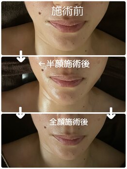 フルール エンビロン(フルール ENVIRON)/ヘッドスパ・フェイシャル　2