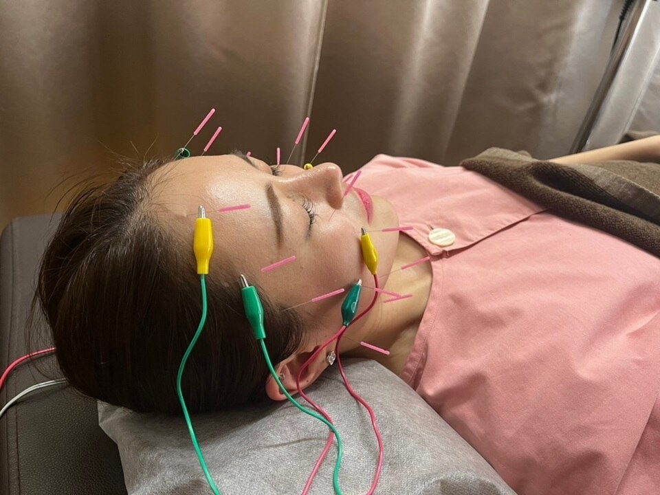 中国鍼灸 健身院|ホットペッパービューティー 中国鍼灸 健身院|ホットペッパービューティー