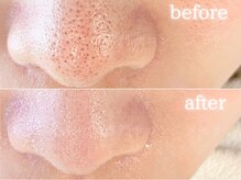 メモリ/お客様の変化