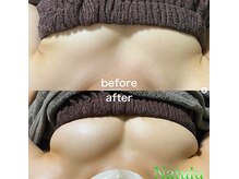 ナチュウル(Natulu)/ボンボンバスト