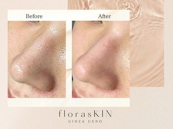 フロラスキン 上野店(florasKIN)