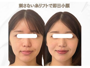 ソナ 大和西大寺院(SONA)/お顔の僅かな凹凸も見逃さない