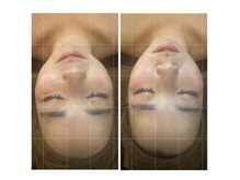 キリグ(KILIG)の雰囲気（【骨格を正しく整える】小顔矯正、一回でこの変化！）