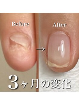 リリー/驚きの変化…！！！！