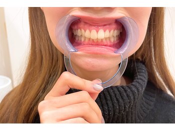 リモード 富士店(REMODE)/*セルフホワイトニング*