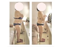 アクア エステティコ 亀有(ACQUA estetico)/脂肪燃焼 中半身3ヶ月 変化 60代