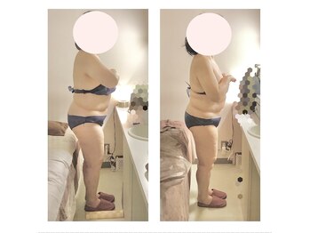 アクア エステティコ 亀有(ACQUA estetico)/脂肪燃焼 中半身3ヶ月 変化 60代